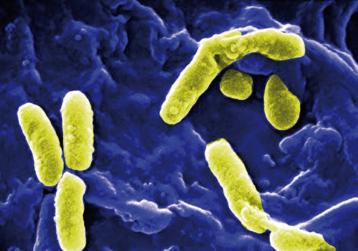 Pseudomonas aeruginosa is one of the most significant pathogens of infection that can be spread through drinking water in buildings.