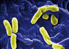 Bakterija Pseudomonas aeruginosa je jedan od najvažnijih uzročnika infekcija koji se u zgradama šire putem pitke vode.